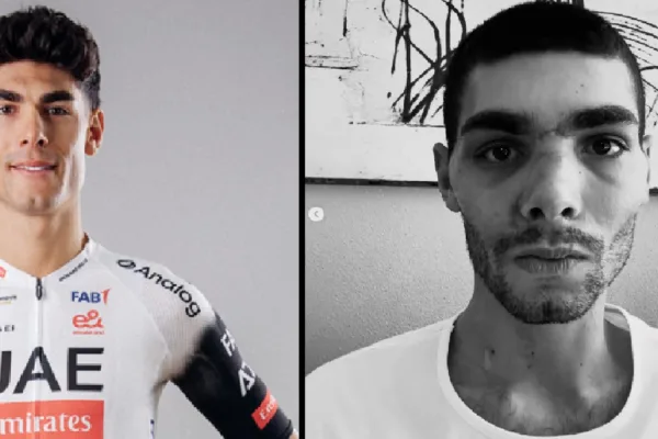 Filippo Baroncini, UAE