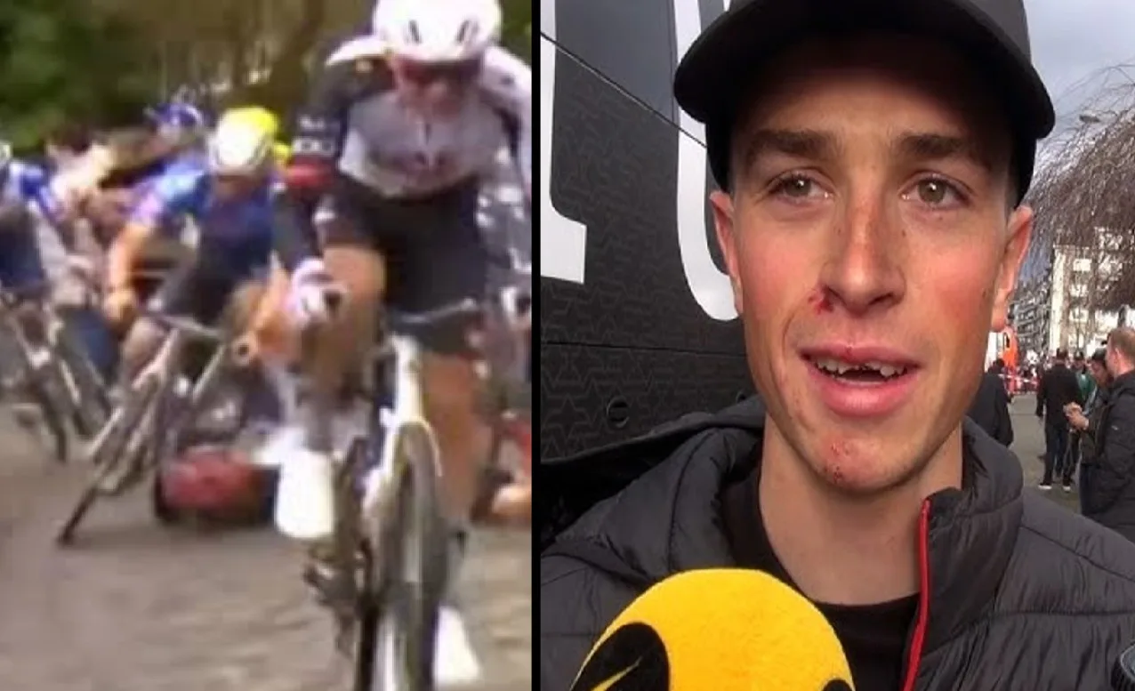 Rick Pluimers (Tudor) tras su caída en Omloop 2026 que lo dejó con dientes rotos.