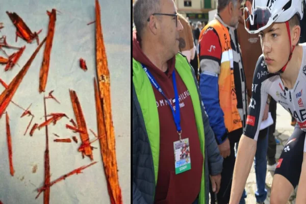 Los trozos de astilla que le extrajeron a Moritz Mauss