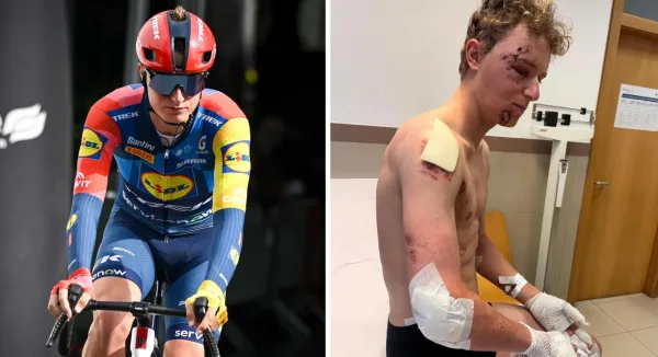 Albert Withen Philipsen (Lidl-Trek) tras su accidente