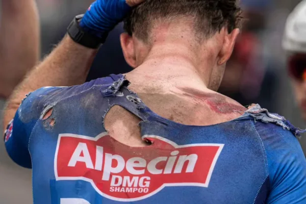 Kaden Groves tras su caída en la etapa 1 del Giro d´Italia 2026