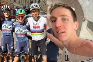 Pogacar retorna a entrenar en ruta y muestra su escalofriante cicatriz en su último día en arcoiris