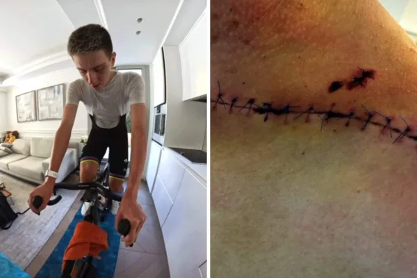 Tadej Pogacar vuelve a entrenar y muestra su herida tras su caída y abandono de La Vuelta 2026